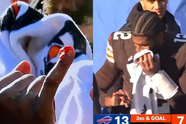 Shedeur Sanders Suffers Bloody Finger Injury vs Bills